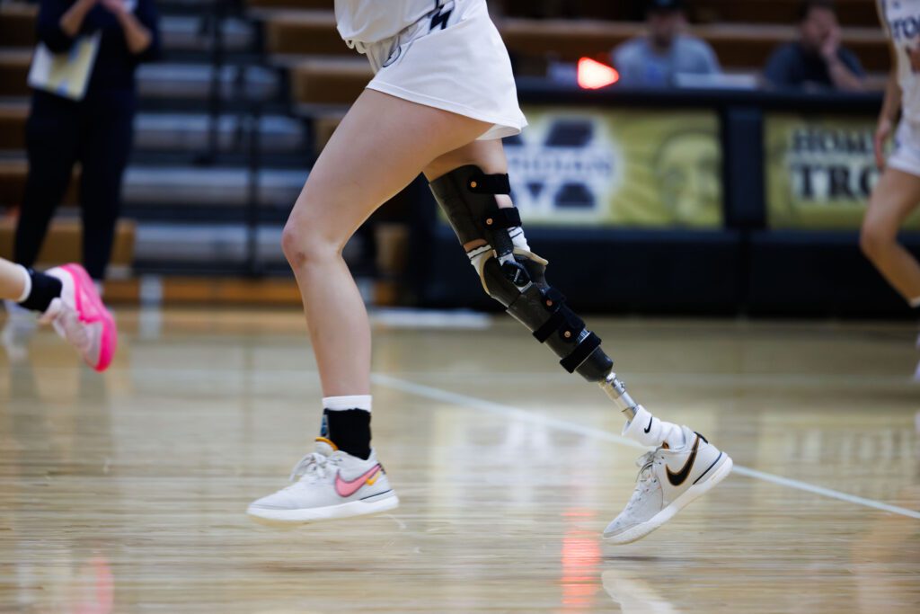 A side photo of Addison Kettman's protestic leg as she runs on the court.